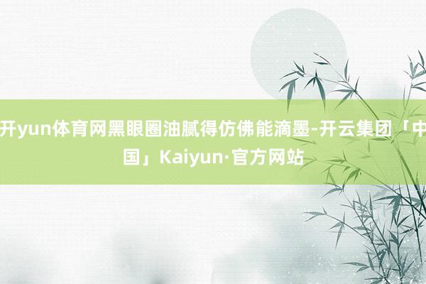 开yun体育网黑眼圈油腻得仿佛能滴墨-开云集团「中国」Kaiyun·官方网站